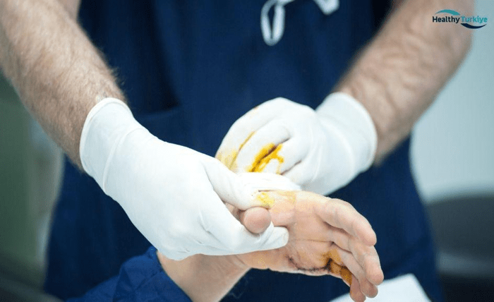 Hand Surgery in Turkey for Restore Function 013